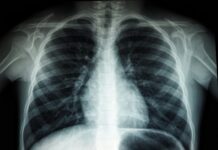 Jak działa nowoczesna pracownia rezonansu magnetycznego? Jak działa nowoczesna pracownia rezonansu magnetycznego